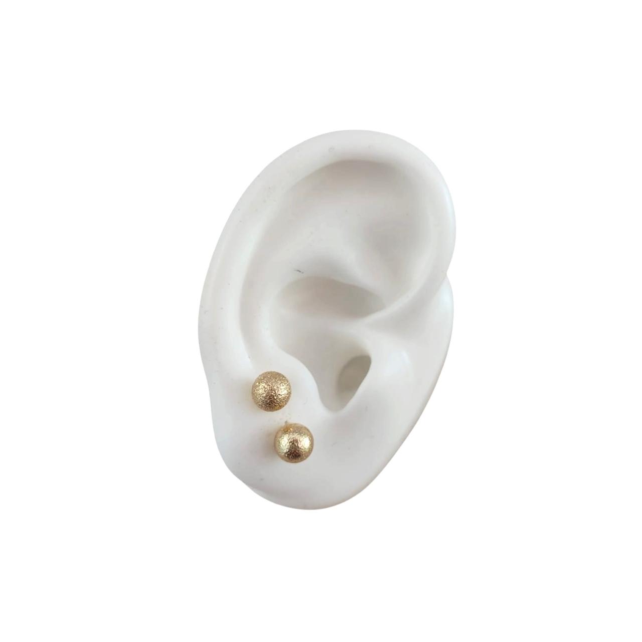 Sets Aretes